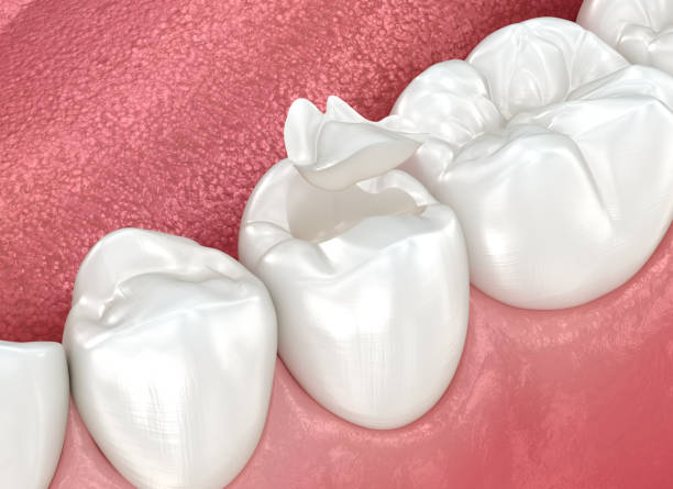 Best Emergency Dental Care  in Island Walk, FL